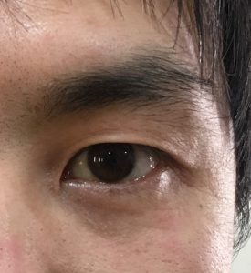 メンズ 眉毛 確認